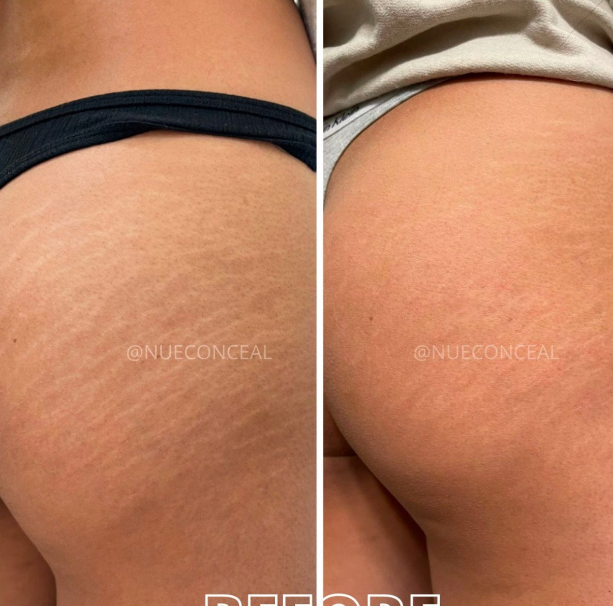 Inkless revision result