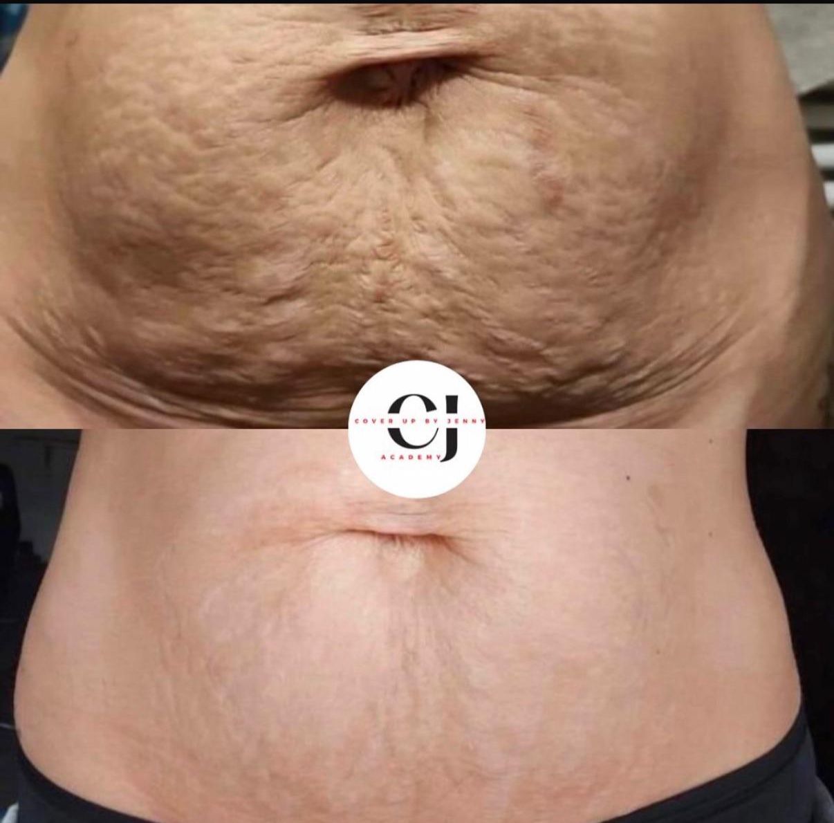 Skin ReNUE before and after — paramedical tattooing transformation