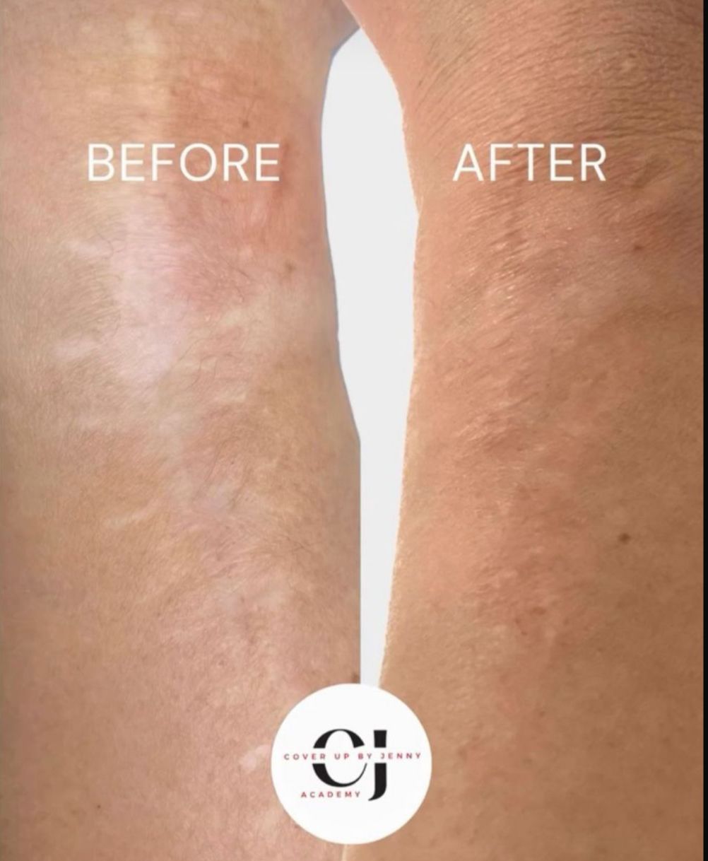 Skin ReNUE before and after — paramedical tattooing transformation