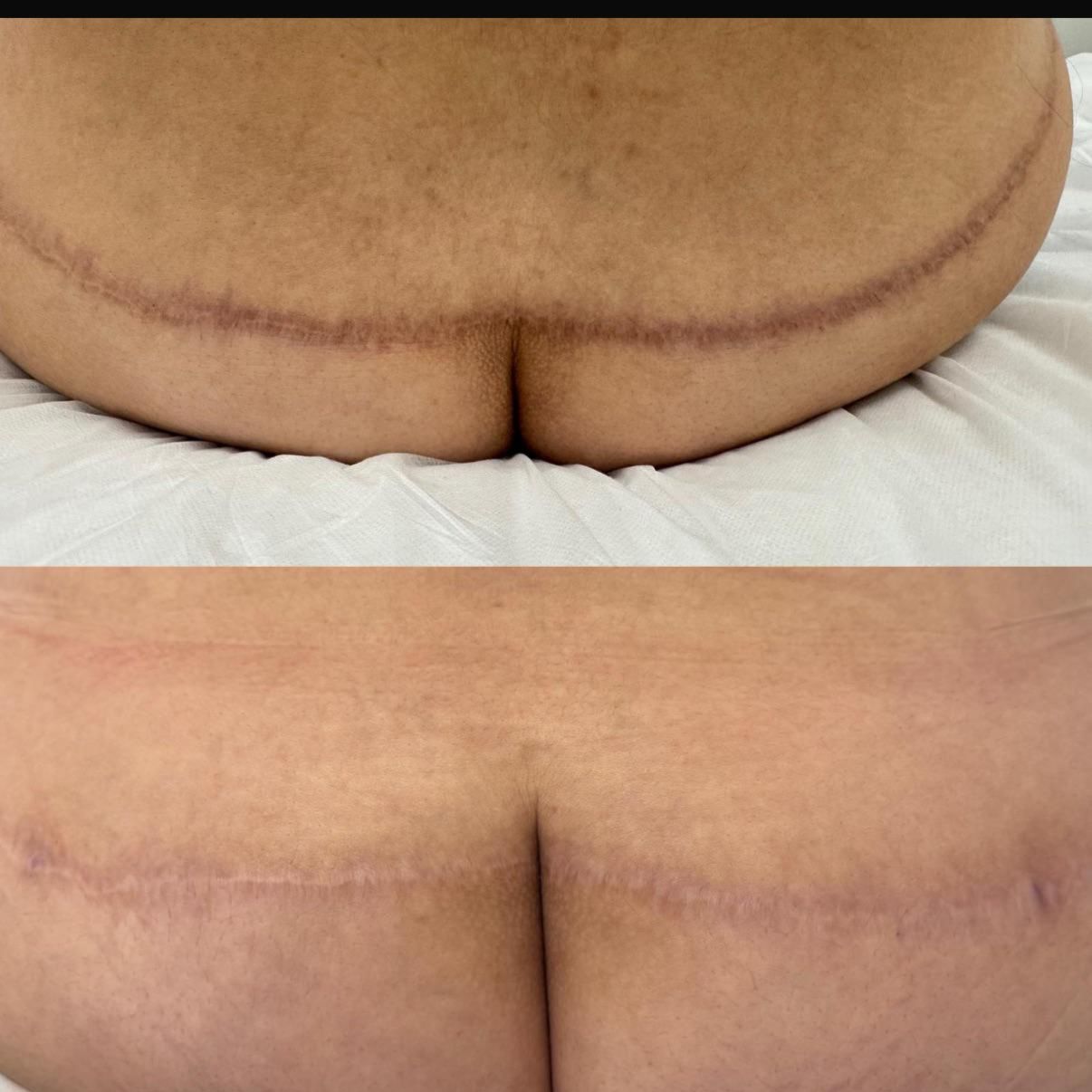 Skin ReNUE before and after — paramedical tattooing transformation