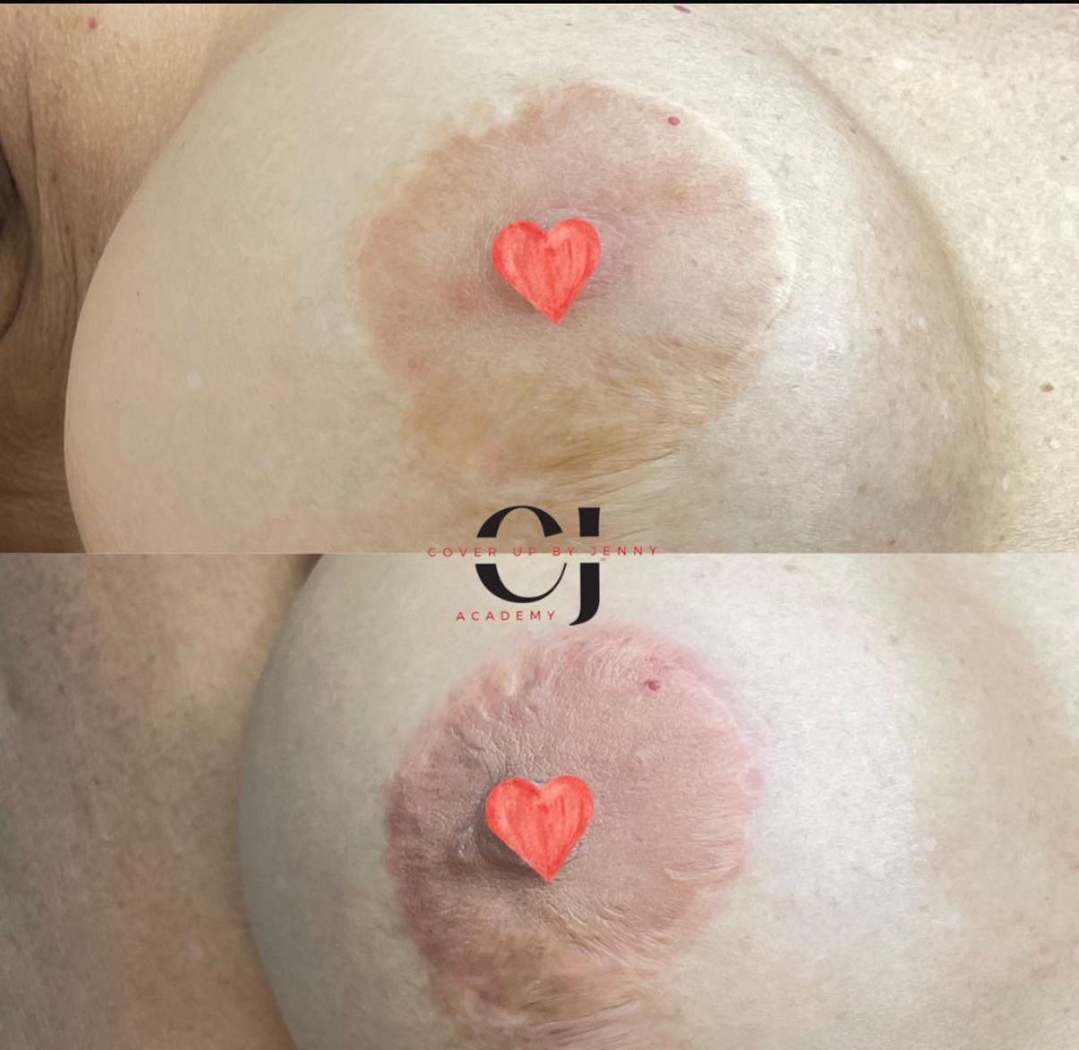 Skin ReNUE before and after — paramedical tattooing transformation