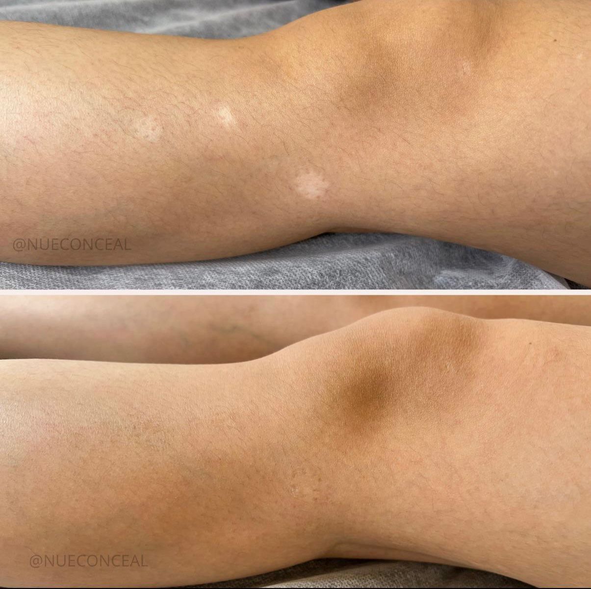 Skin ReNUE before and after — paramedical tattooing transformation