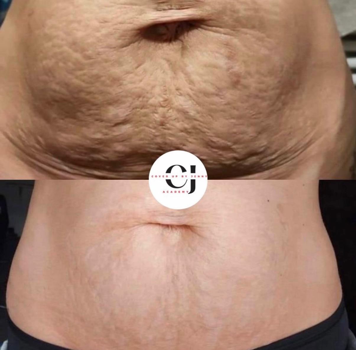 Skin ReNUE before and after — paramedical tattooing transformation