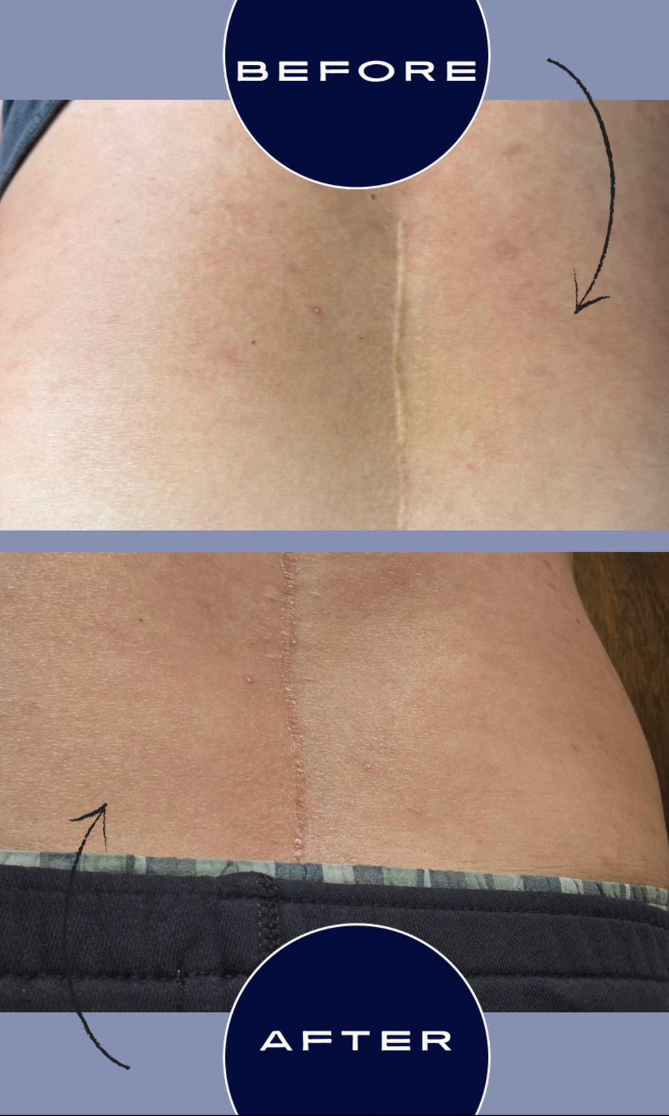 Skin ReNUE before and after — paramedical tattooing transformation