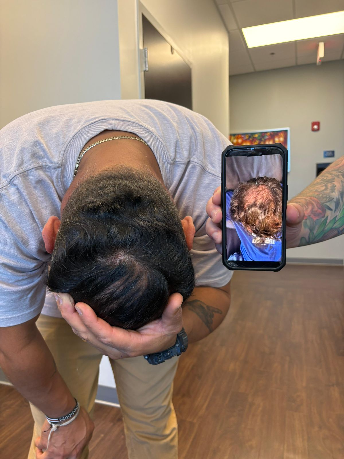 Skin ReNUE before and after — paramedical tattooing transformation